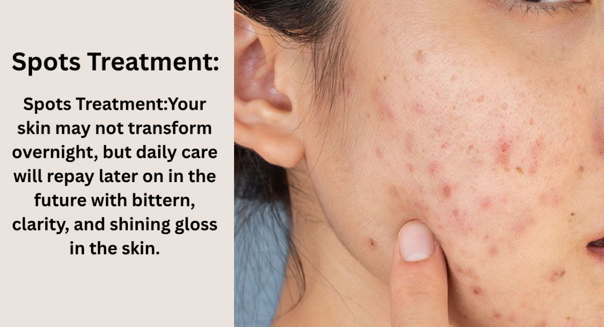 Spot Treatment: